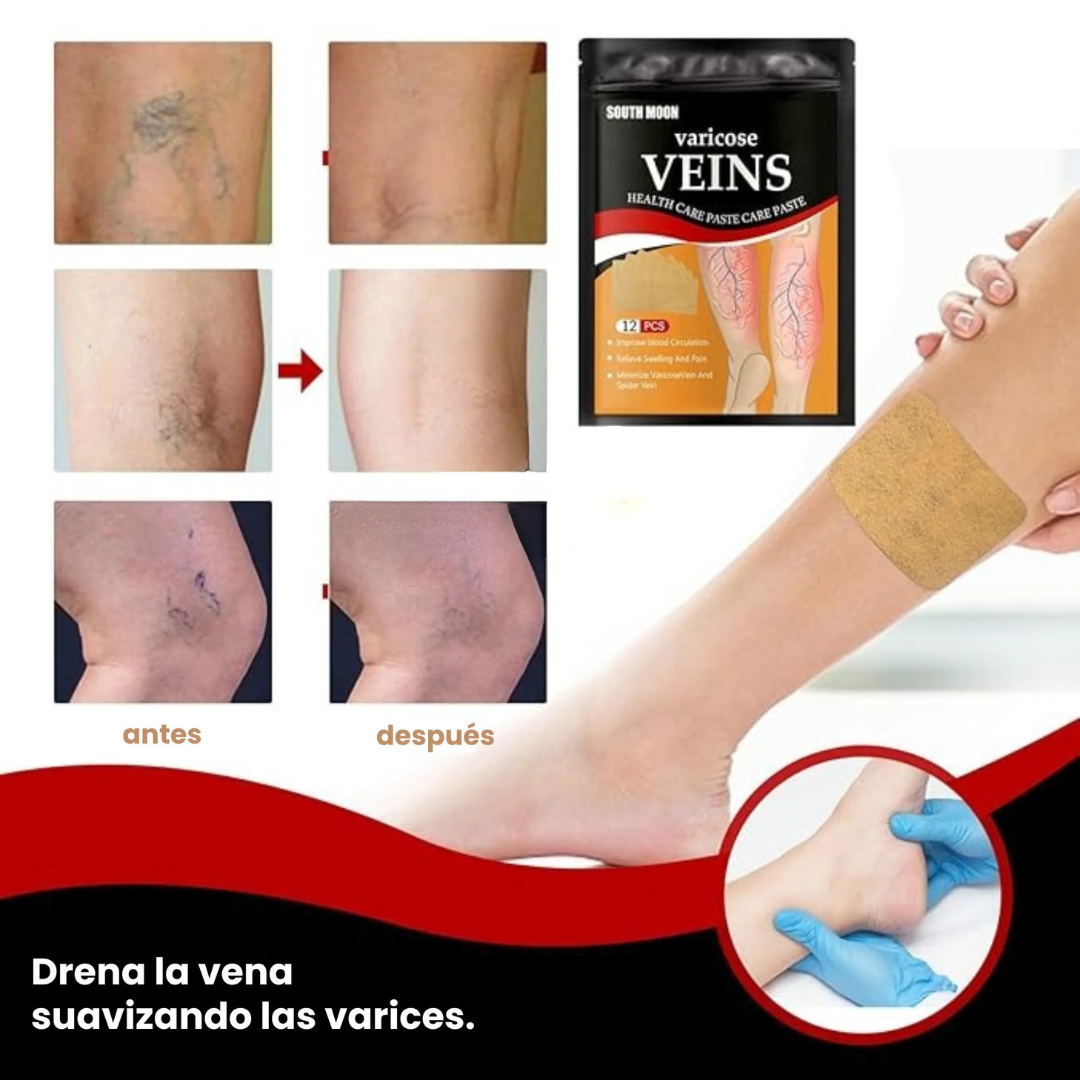 Parches Varicose Veins™ (Solución definitiva para las varices)+ PAGA AL RECIBIR + ENVÍO GRATIS 🎁