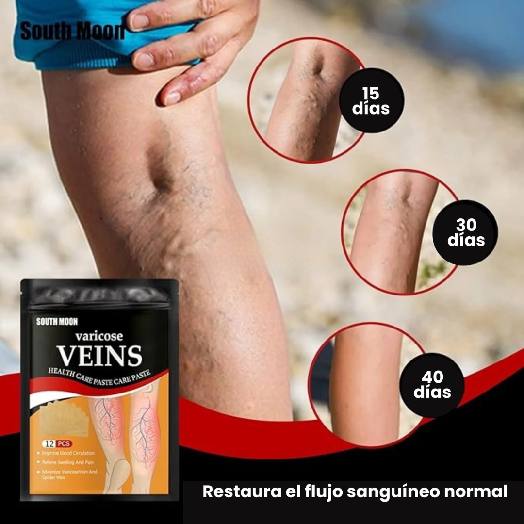 Parches Varicose Veins™ (Solución definitiva para las varices)+ PAGA AL RECIBIR + ENVÍO GRATIS 🎁