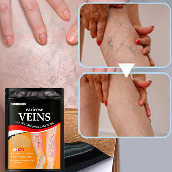 Parches Varicose Veins™ (Solución definitiva para las varices)+ PAGA AL RECIBIR + ENVÍO GRATIS 🎁